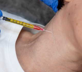 Neck Skin Booster Injections