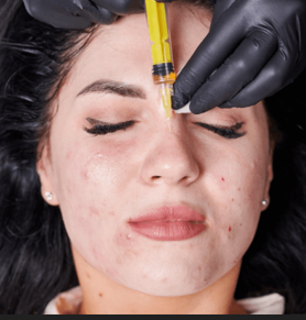 Pimple Injections