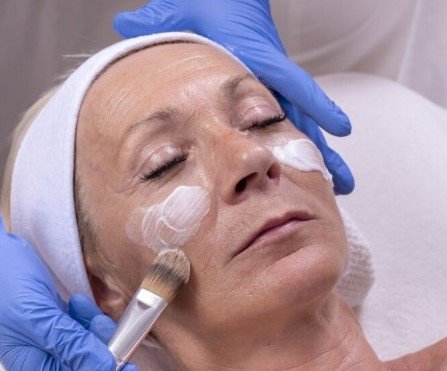 Pyruvic Acid Peel