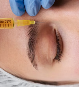 Quick Tear Trough Sculpting Fillers