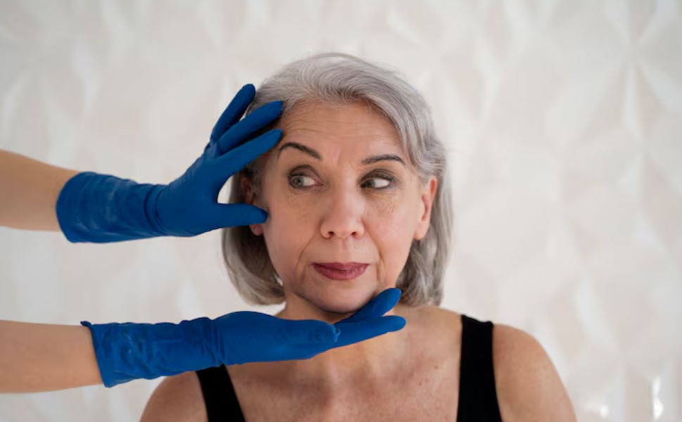 Thermage Wrinkle Reduction