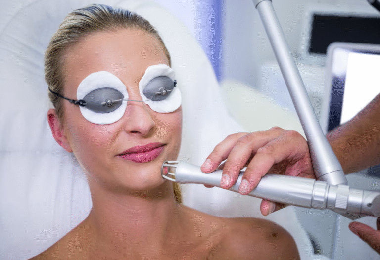 Laser Skin Tightening