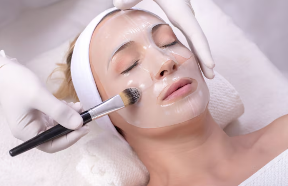 Chemical Peel