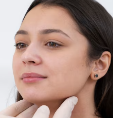 Sharp Jawline Contouring Treatment