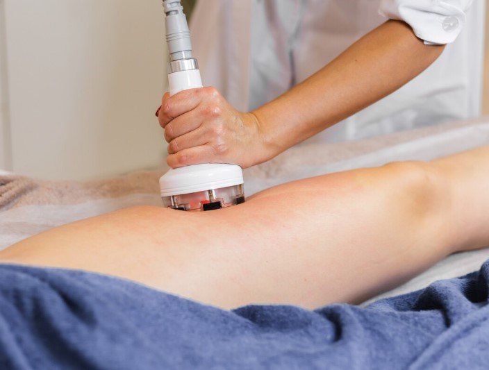 Cryolipolysis Arm