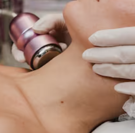 Ultrasound Jawline Tightening