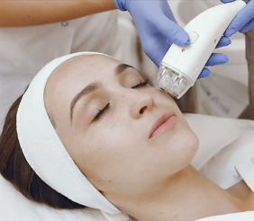 UltraPulse CO₂ Laser Whitening