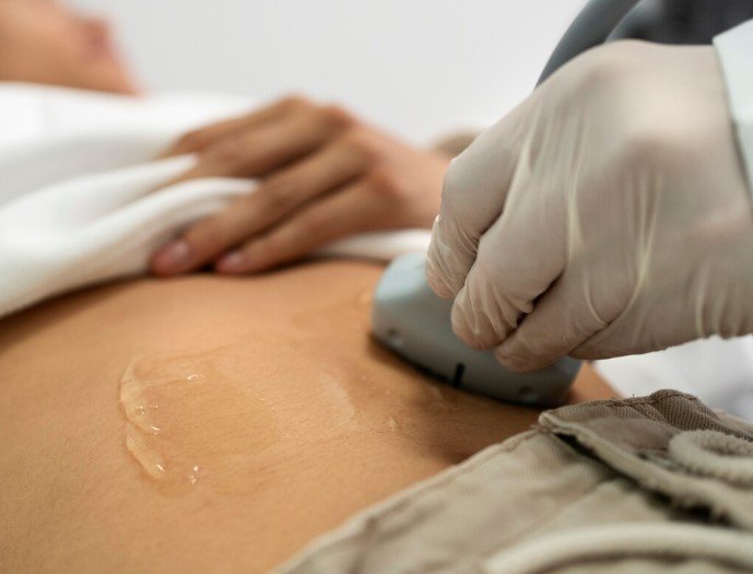 Ultrasound Lipolysis
