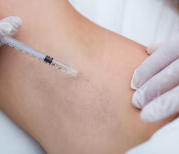 Underarm Fat Dissolving Injections