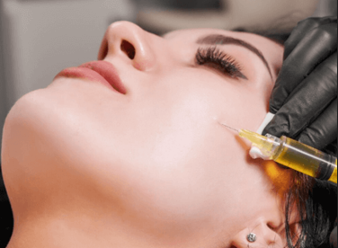 Vitamin Cocktail Microneedling