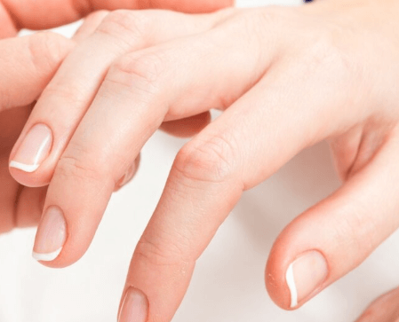 Volume Restoration Hand Rejuvenation
