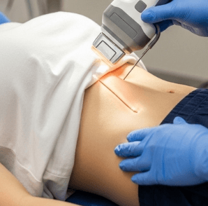 Waist & Flank Skin Tightening