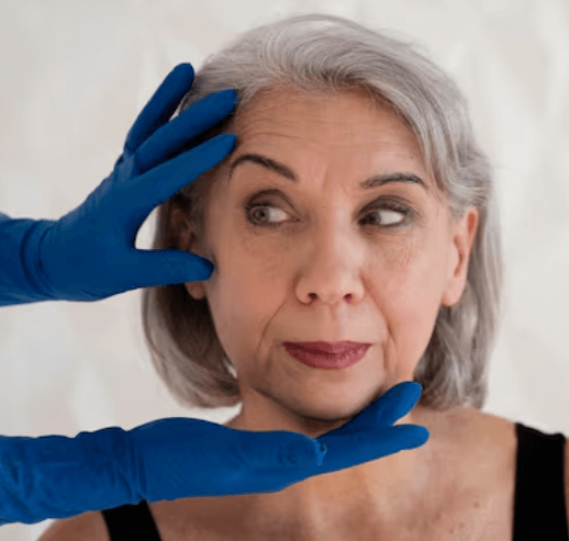 Wrinkle Reduction Microneedling Facial