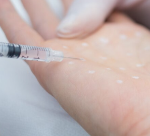 Youthful Hands Filler Treatment