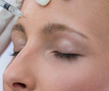 Profile Balancing Forehead Fillers