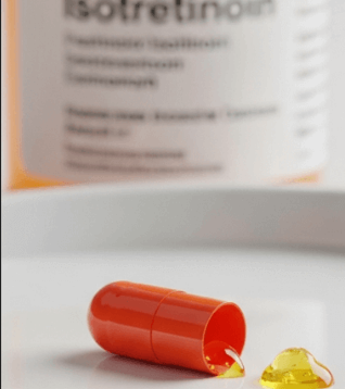 Oral Isotretinoin