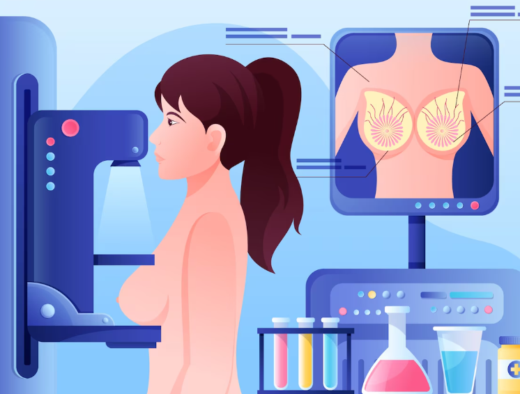 Advanced 3D Breast Tomosynthesis