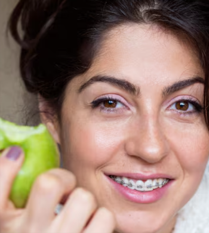 Advanced Lingual Braces