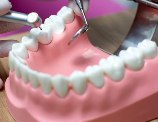 Aesthetic Implant Bridge