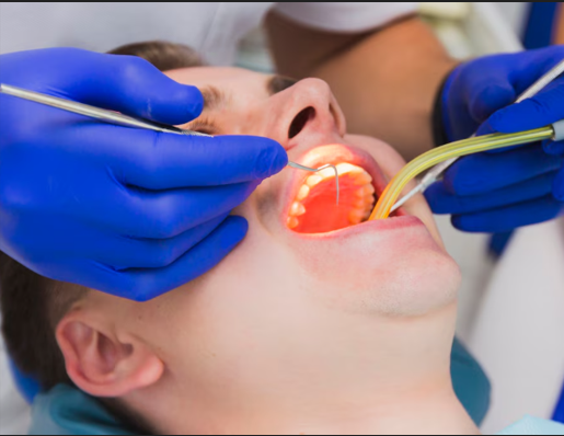 Aesthetic Clear Aligners