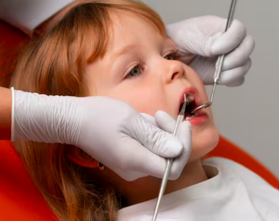 Baby Tooth Sealant Application