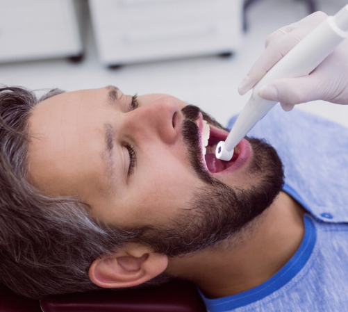 Deep Enamel Strengthening Fluoride