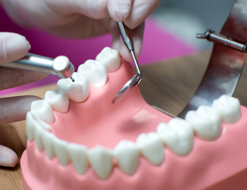 Complete Ceramic Denture Restoration