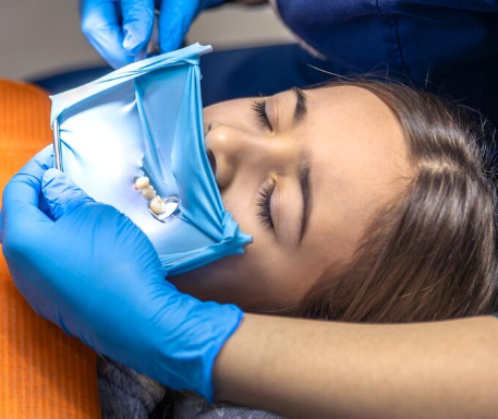 Enamel Contour Polishing