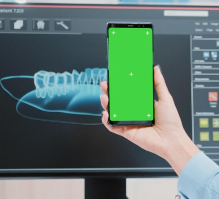 Digital Bone Graft Planning