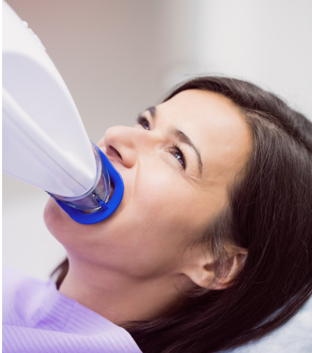 Full Mouth Reconstruction