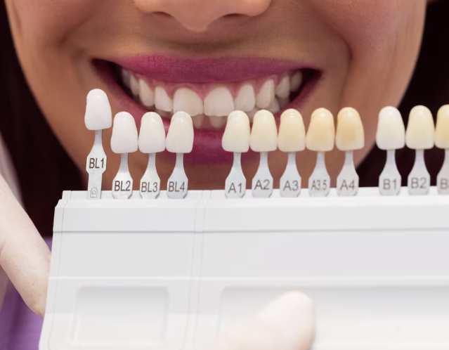 Front Teeth Mini Dental Implants