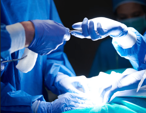 Endometriosis Ablation Surgery