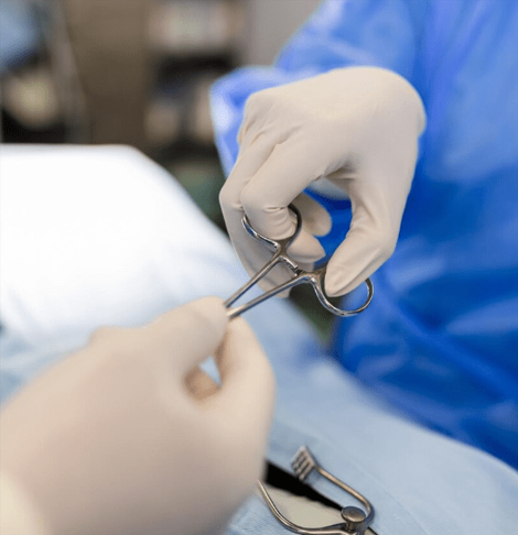 Endometriosis Surgical Adhesiolysis