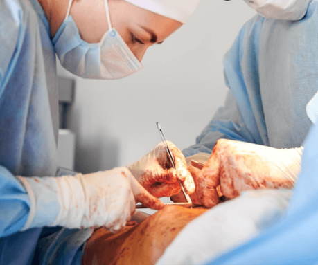Endoscopic-Assisted Endometriosis Surgery