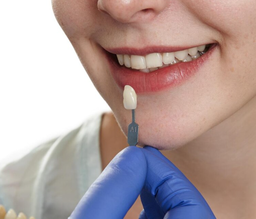 Full Ceramic Crown Restoration