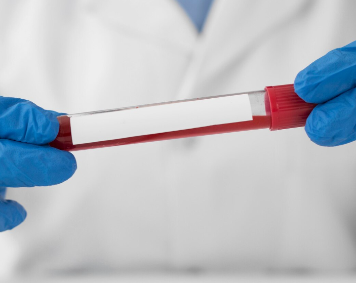 HIV Testing & Counseling