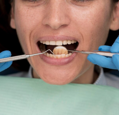 Indirect Composite Bridge