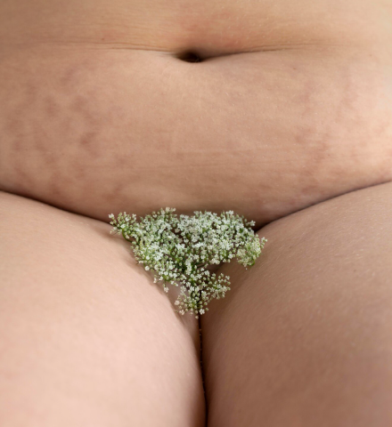 IntimaPlus Fat Graft Labia Majora