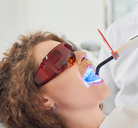 Laser-Assisted Tooth Filling Preparation