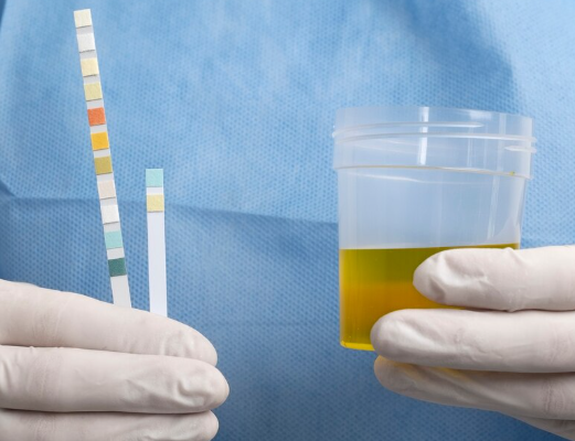 Liquid-Based Pap Test