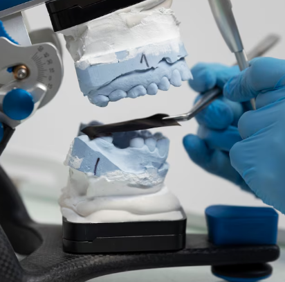 Lithium Disilicate Inlay