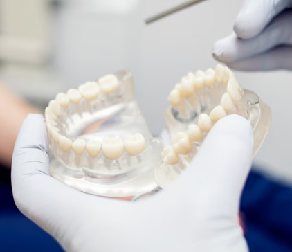 Locator Attachment Implant Dentures