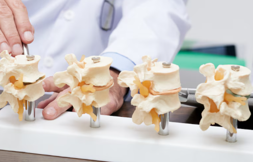 Low Bone Mini Implants