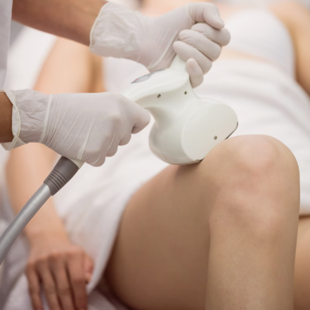 LumiViva Intimate Laser Toning