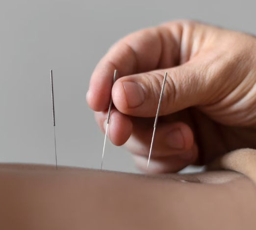 Meridian Balance Acupuncture
