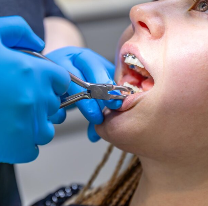 Metal-Free Zirconia Implant Bridge