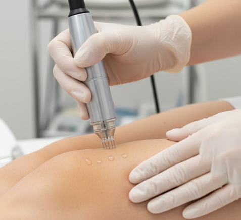 Micro Filler G-Shot Rejuvenation