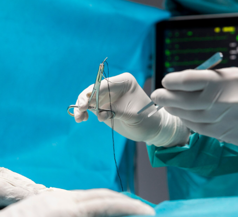 Microsurgical Bartholin Gland Excision