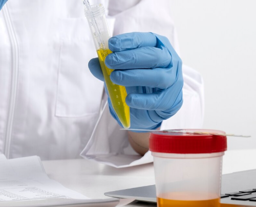 Mycoplasma Genitalium Testing & Treatment