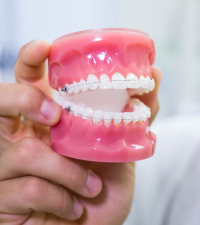 Natural-Look Single Tooth Implant